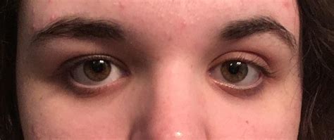 Are my eyes hooded? If not, what eye shape? : r/HoodedEyes