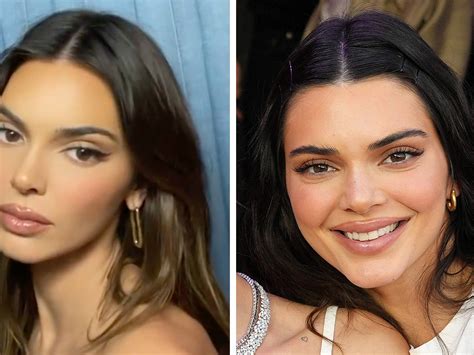 kendall jenner before plastic surgery 2