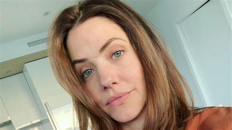 Julie Gonzalo’s Scar: Birth Mark or What?