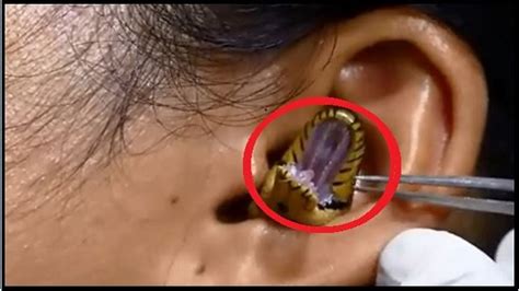 Viral video: Snake stuck in woman's ear stuns internet!