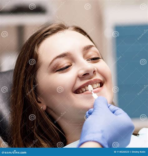 Patient`s Teeth Shade with Samples for Bleaching Treatment. Stock Image