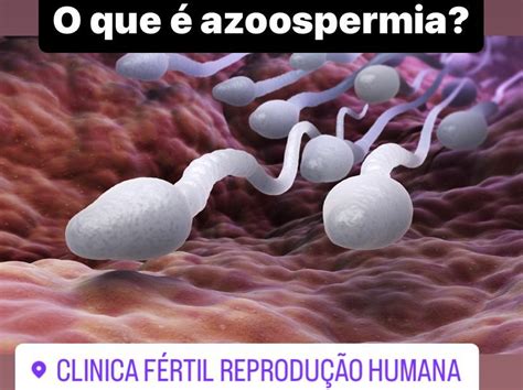 Meu Marido Tem Azoospermia E Eu Engravidei