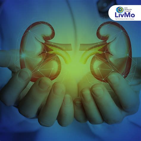 La Gammagrafía renal permite... - Medicina Nuclear Menonita