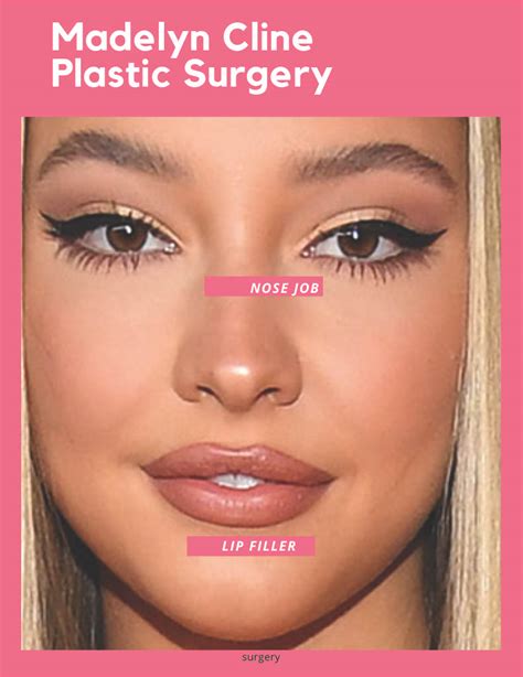 Madelyn Cline Plastic Surgery: Find All the Details Here