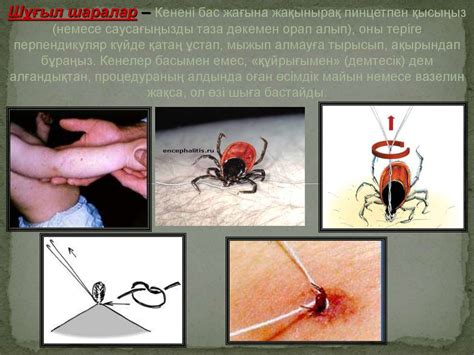 Кене энцефалиті - презентация онлайн