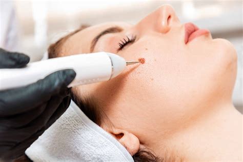 Define Dermatology & Aesthetics – Dermatologist Clinic