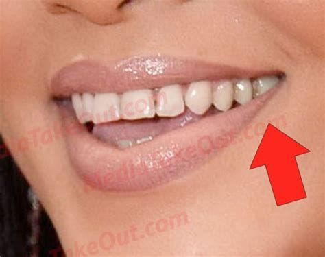 MTO did an upclose of Rihanna's teeth - All about facts