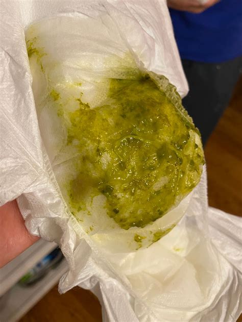 TMI: POOP! My Baby's Poop Has Been Green The Last Couple Of, 48% OFF