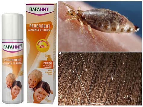 Парaнит от вшей: цена, отзывы и инструкция по применению