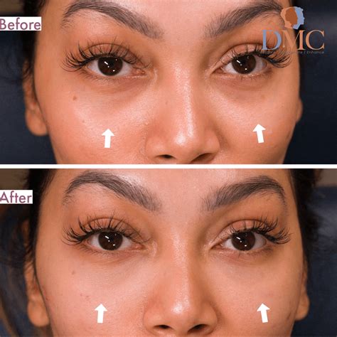 Transformation Results - Derma Medical Clinics