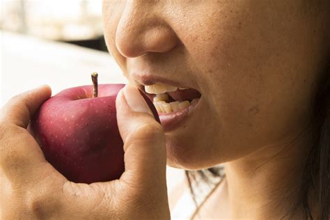 How To Whiten Teeth At Home With Banana Peel at Randal Canada blog
