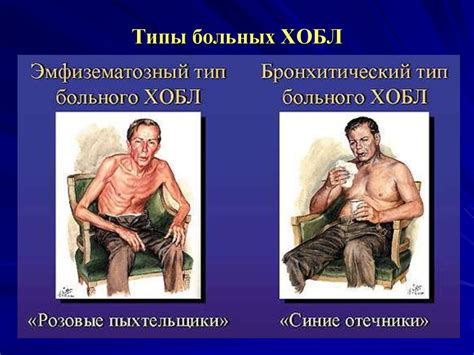 ХОБЛ – диагностика, лечение - презентация онлайн