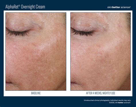 Skinbetter science Skincare