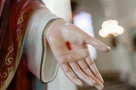 Wound Photos, Download The BEST Free Wound Stock Photos & HD Images