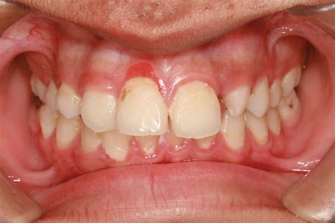 6 Common Infections | Britannica
