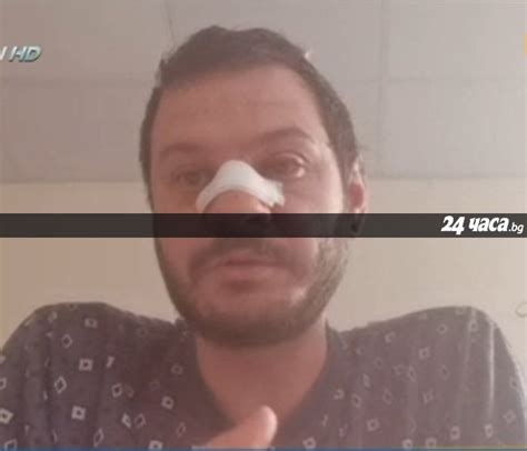 Мъж подава жалба срещу полицай, счупил му носа с палка на протеста ...