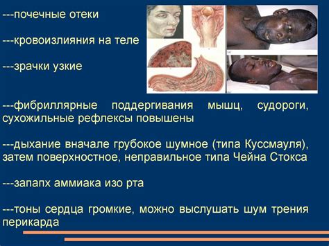 Уремическая кома. Интенсивная терапия - презентация онлайн