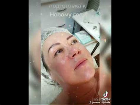 Без травм и шелушения пилинги всесезонные. Результат мгновенный! - YouTube