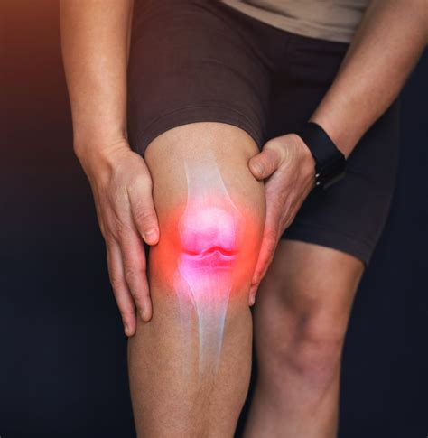 Meniscus Injury Treatment - Dr Paul Macnamara