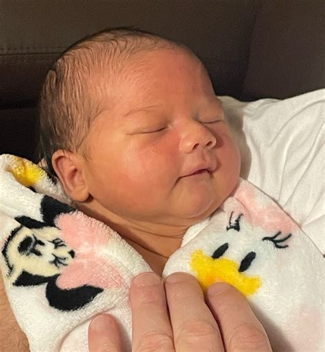 What a microscopic vasectomy reversal "technical" success looks like