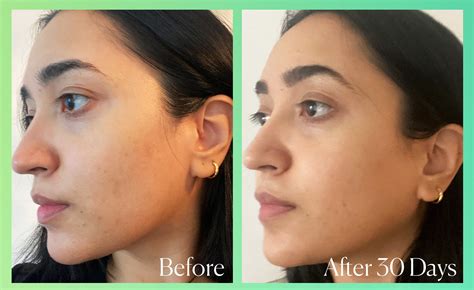 An Honest Review Of Good Molecule’s Discoloration Correcting Serum ...