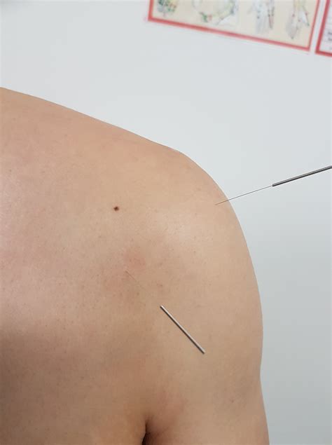 One of the most common... - The Hills Health Clinic