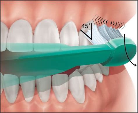 Modified Bass Technique | How to Brush your Teeth Properly | Brushing ...