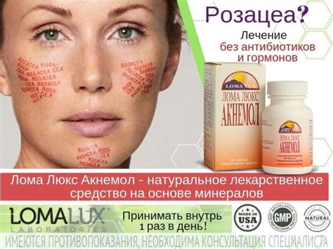 Крема При Розацеа Лучшие Аптечные Средства — Tutaptekar.ru