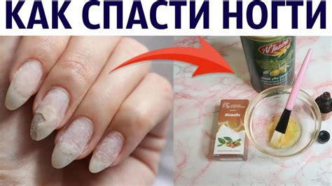 как нарастить ногти дома детям - uniformcustomize