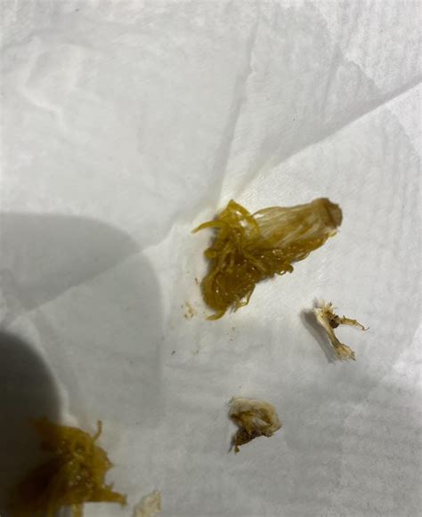 (pg 257, 357) nausea, fatigue, vomitting, dizziness, pain in muscles