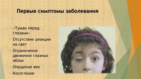Ботулизм. Симптомы и профилактика. - YouTube