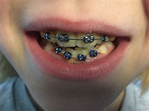 Orthodontist Near Me