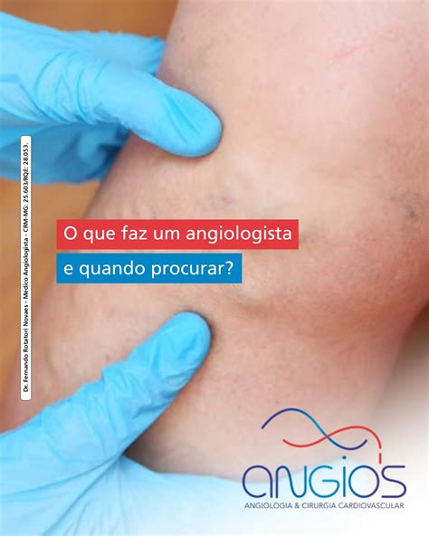 Medico Angiologista Faz O Que - Clínica Angios - 🩺 O que faz um angiologista e quando... | Facebook