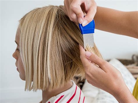 How to Catch Lice in Blonde Hair: Remedies and Treatment