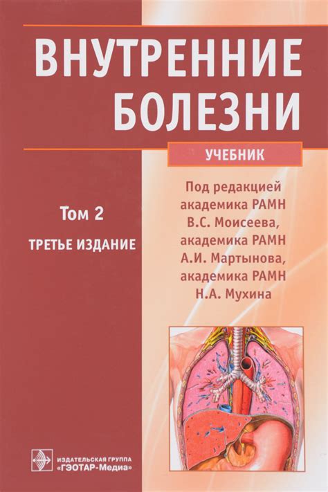 Книга "Внутренние болезни. Учебник. В 2 томах. Том 2 (+ CD)" – купить ...