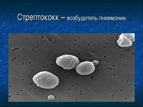 Презентация "Патогенные бактерии" - скачать бесплатно
