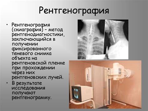 Рентгеновская и позитронная томография - презентация онлайн
