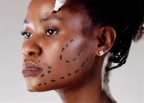 Facial Asymmetry Causes and Treatments | RealSelf News