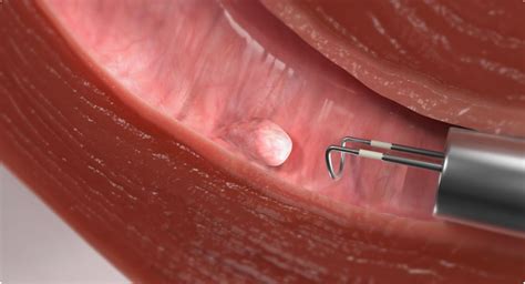 gynecology fertility treatments tailored  women