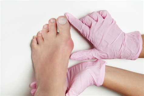Difference Between Bunion and Hallux Valgus | Northwest Surgery Center