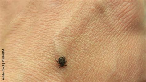 dog tick dermacentor variabilis encephalitis ixodes scapularis