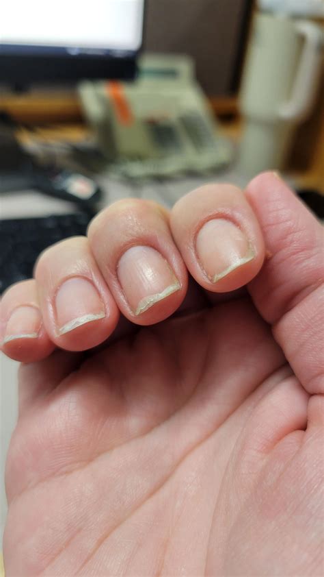 I don't know why my nails keep splitting : r/Nails