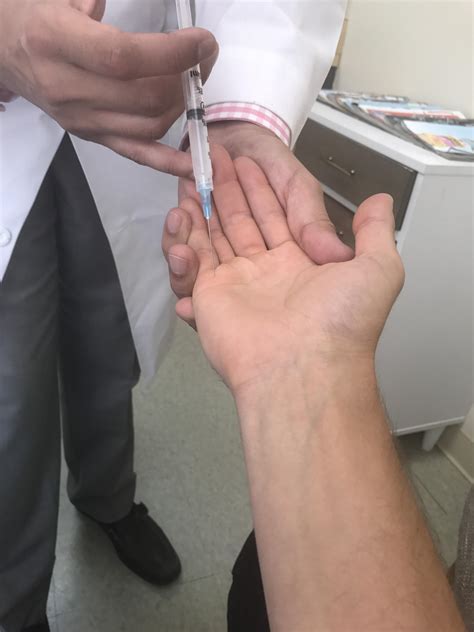 Too much golf too quick = trigger finger : r/golf