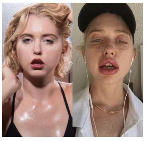 Chloe Cherry before and after pics : r/redscarepod