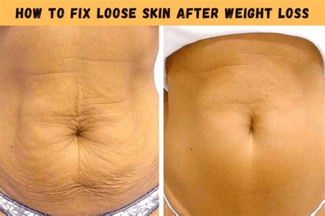 how to fix loose skin