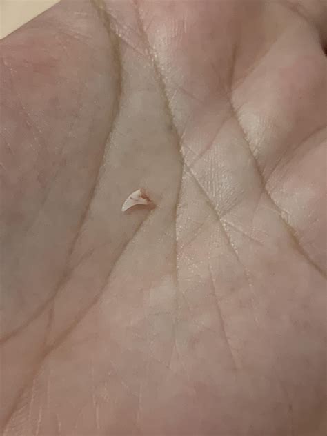 kitten tooth or claw? : r/catcare