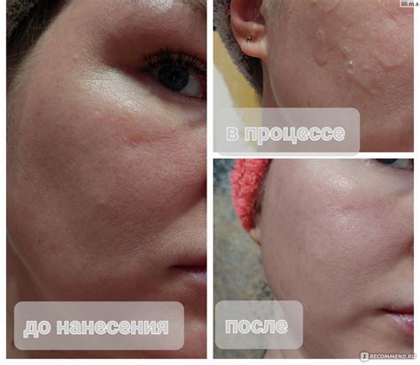 Сыворотка для лица Stellary SKIN STUDIO MULTIVITAMIN SERUM - «Сыворотка ...