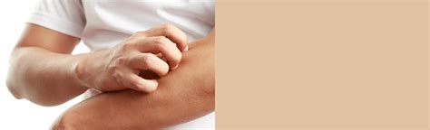 dry irritated skin   products  irritated skin aveeno