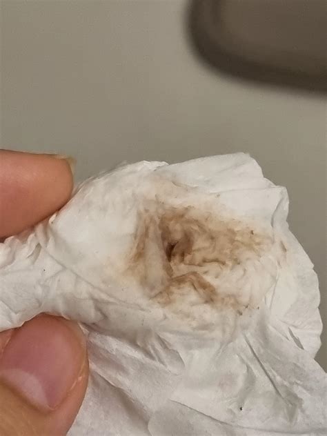 brown discharge  period  xntbsa