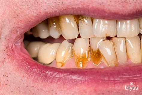 top  common dental problems  treatments prevention